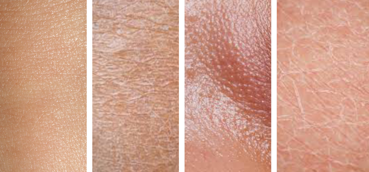 How to Figure Out Your Skin Type